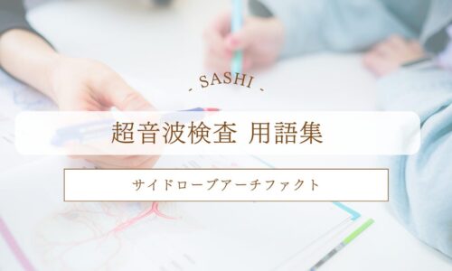 サイドローブアーチファクトについて