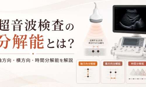超音波検査の分解能について、軸方向分解能・横方向分解能・時間分解能を図解し、超音波装置とモニターを配置したアイキャッチ画像