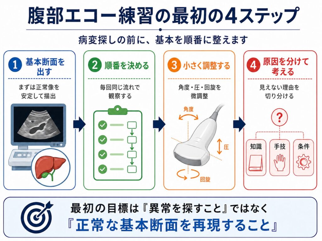 腹部エコー練習の最初の4ステップを、基本断面、観察順、コンベックス型プローブの操作、原因分析の流れで示した図解