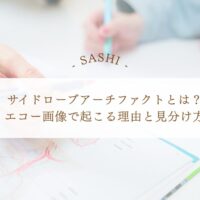 サイドローブアーチファクトの原因と見分け方を解説