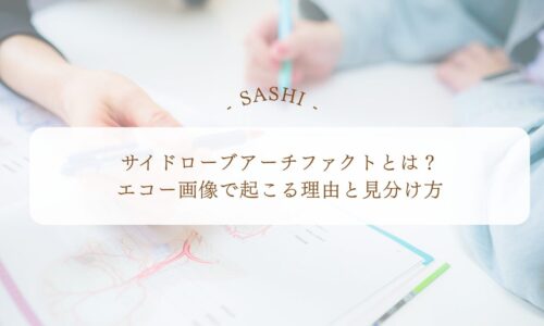 サイドローブアーチファクトの原因と見分け方を解説