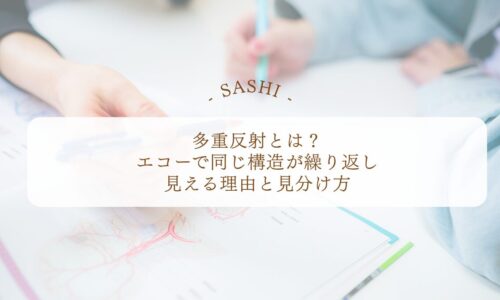 多重反射がエコー画像で繰り返し見える理由と見分け方