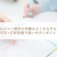 心エコー波形の外縁トレースで迷いやすい計測ポイント
