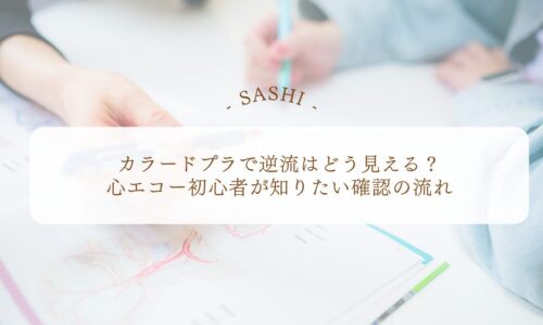 カラードプラ逆流確認の流れを学ぶ心エコー基礎