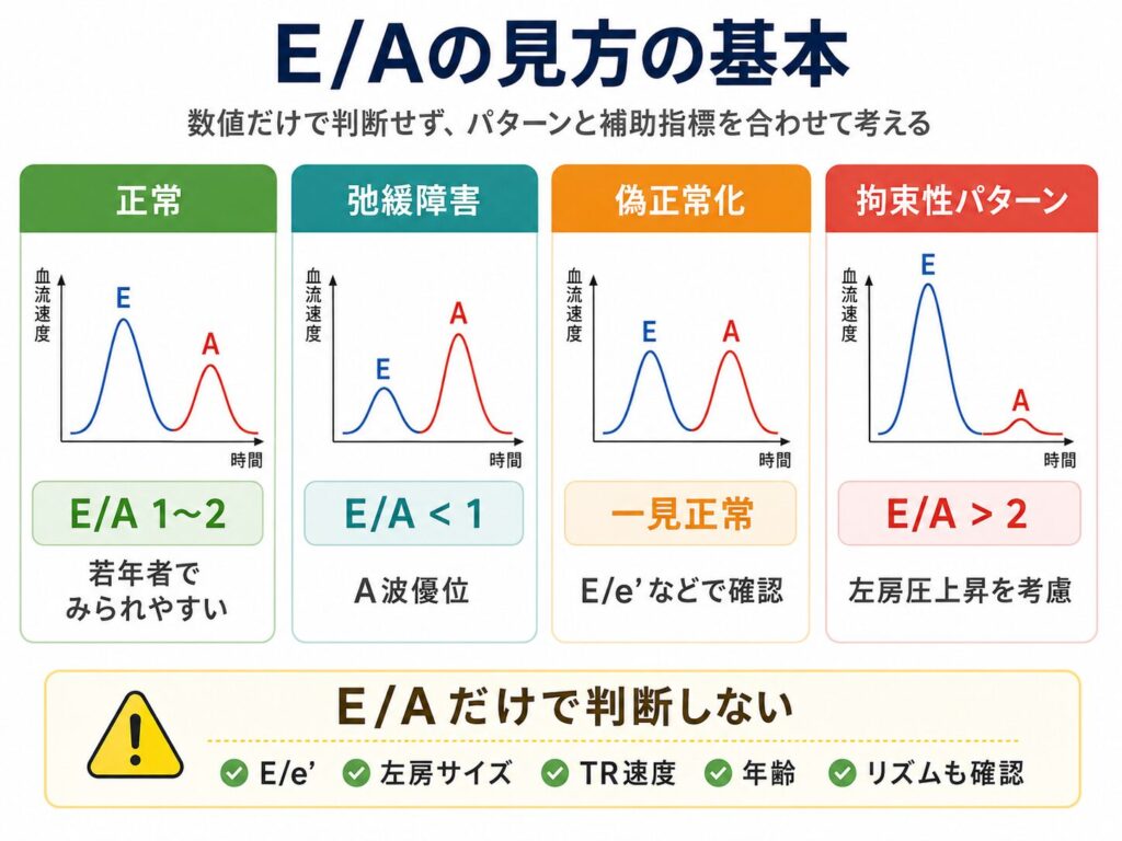 心エコーのE/Aの見方を、正常、弛緩障害、偽正常化、拘束性パターンに分けて示した図解