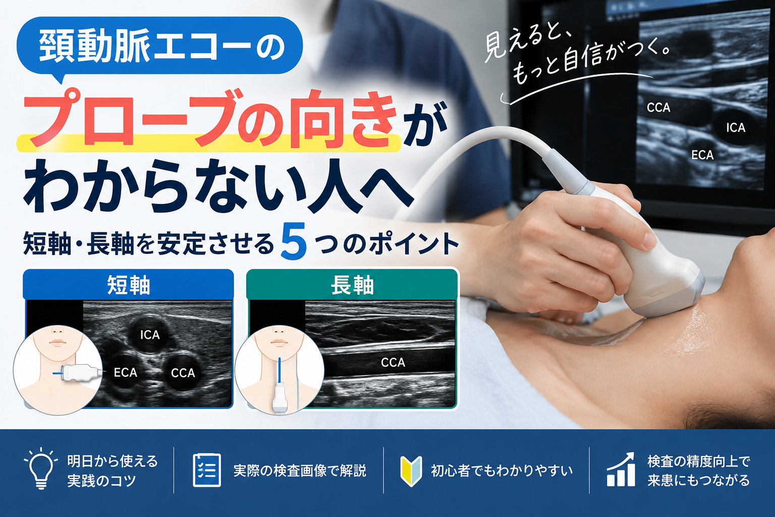 頸動脈エコーでプローブの向きに迷う初心者向けに、短軸・長軸の当て方と超音波画像を解説するアイキャッチ画像